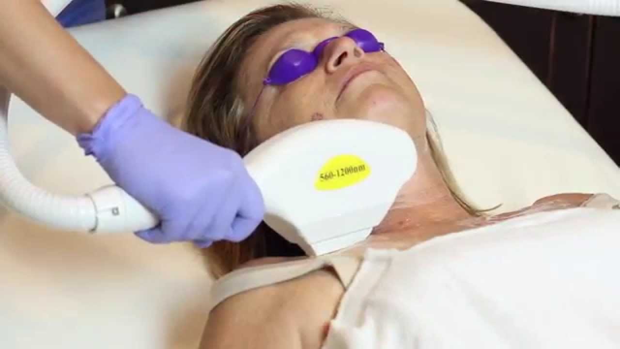 Laser Hair Removal in Phoenix, AZ
