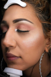 Rhinoplasty 6 After Image