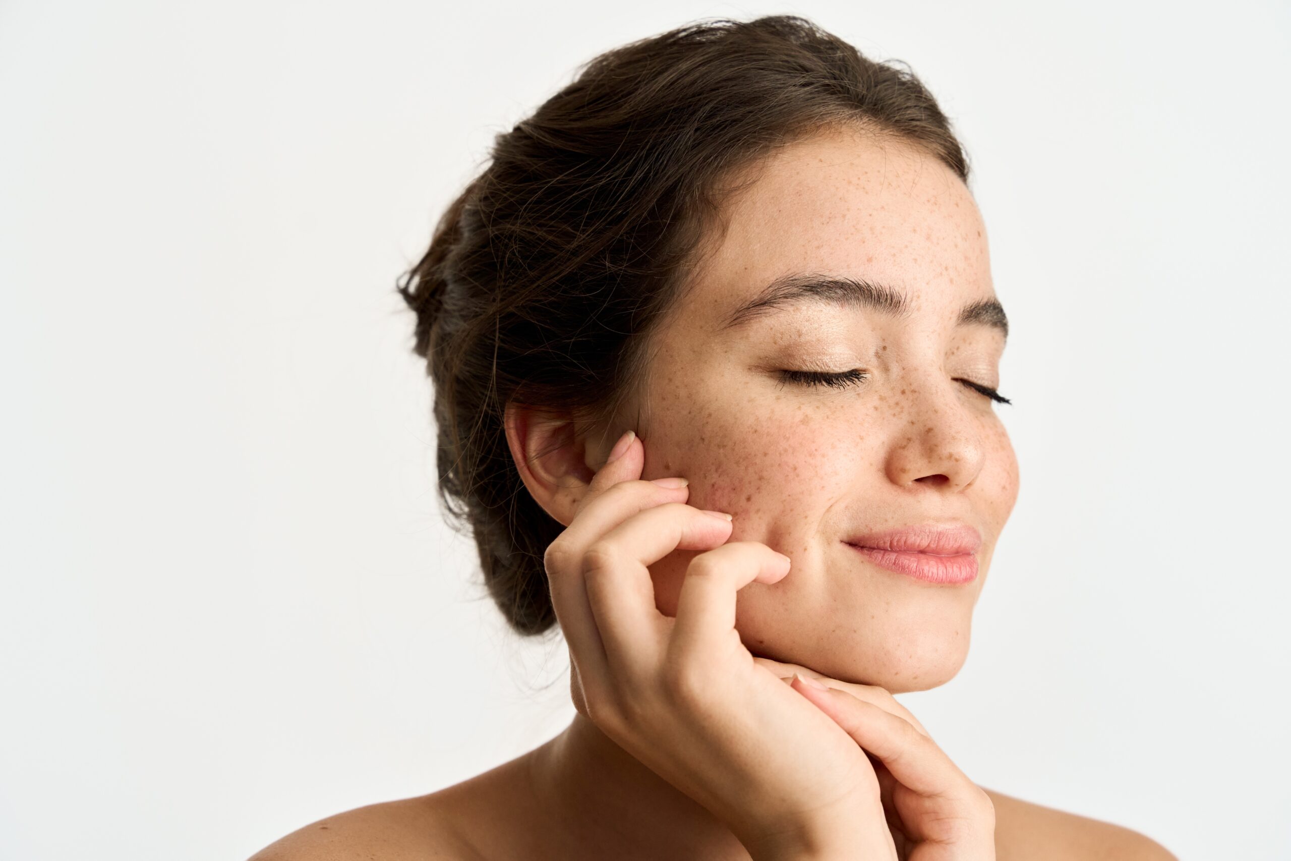 Transform Your Complexion with CO2 Fractional Laser Resurfacing Phoenix, AZ
