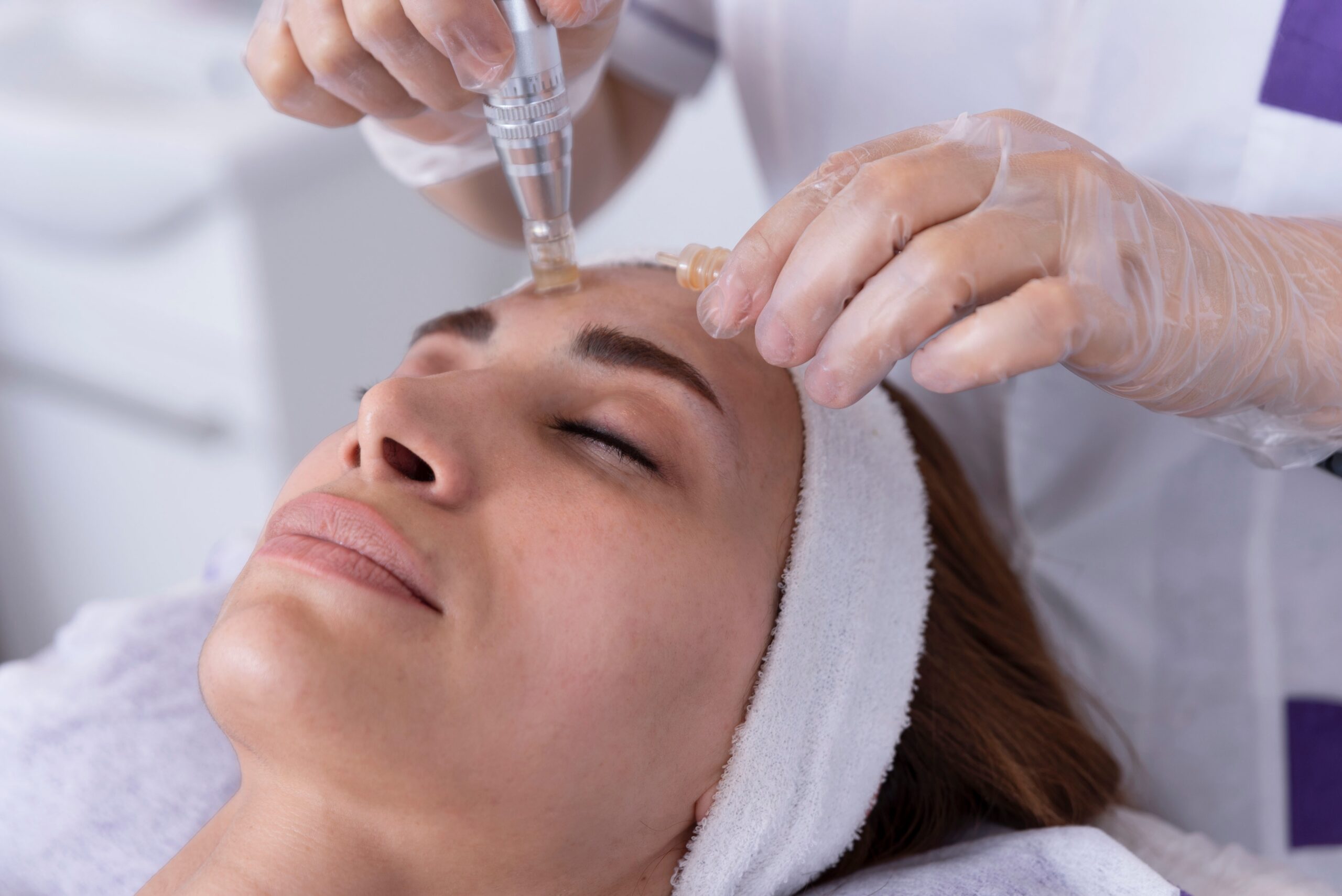 Microneedling in Phoenix for Powerful Skin Renewal and Combination Treatments