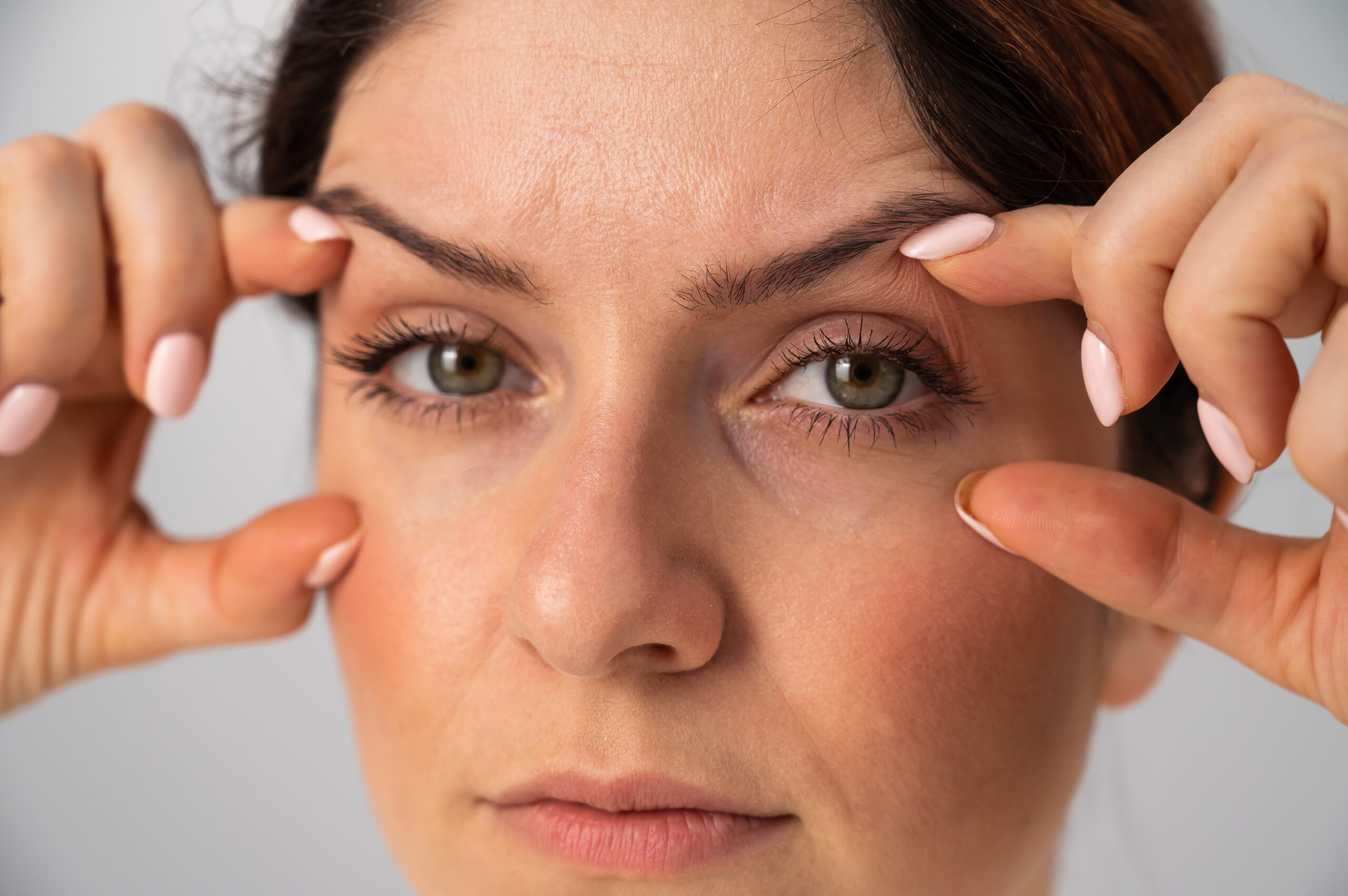 Blepharoplasty in Paradise Valley, AZ